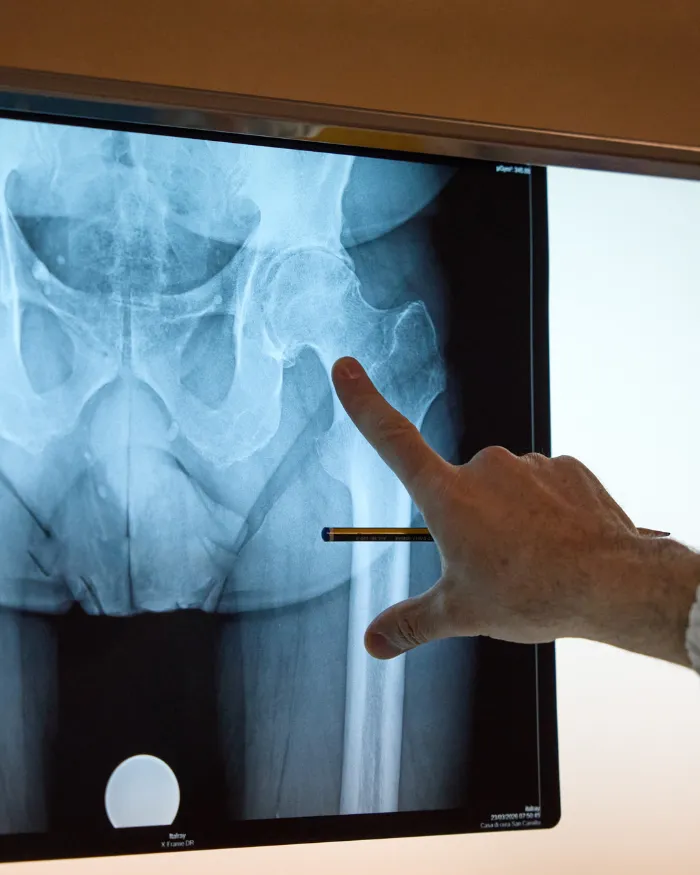 Radiografia del bacino e delle anche