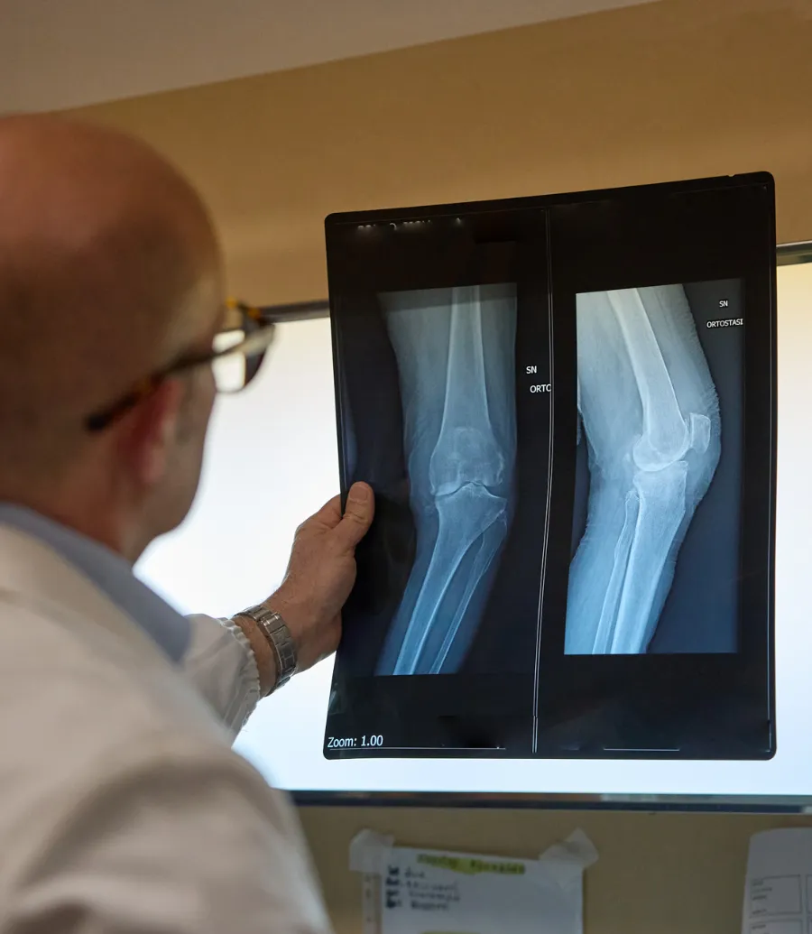 Il Dr. Miele valuta una radiografia del ginocchio
