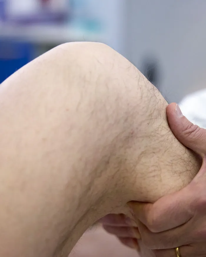 Visita clinica del ginocchio