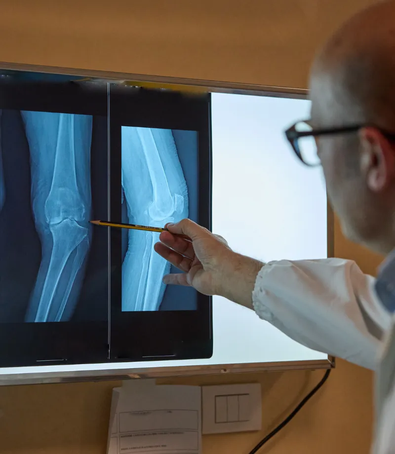 Il Dr. Miele indica una radiografia del ginocchio